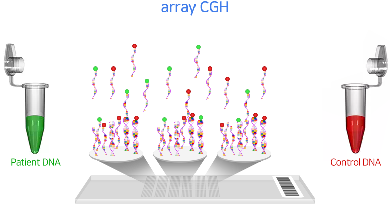 Chromosomal Microarray 설명 이미지